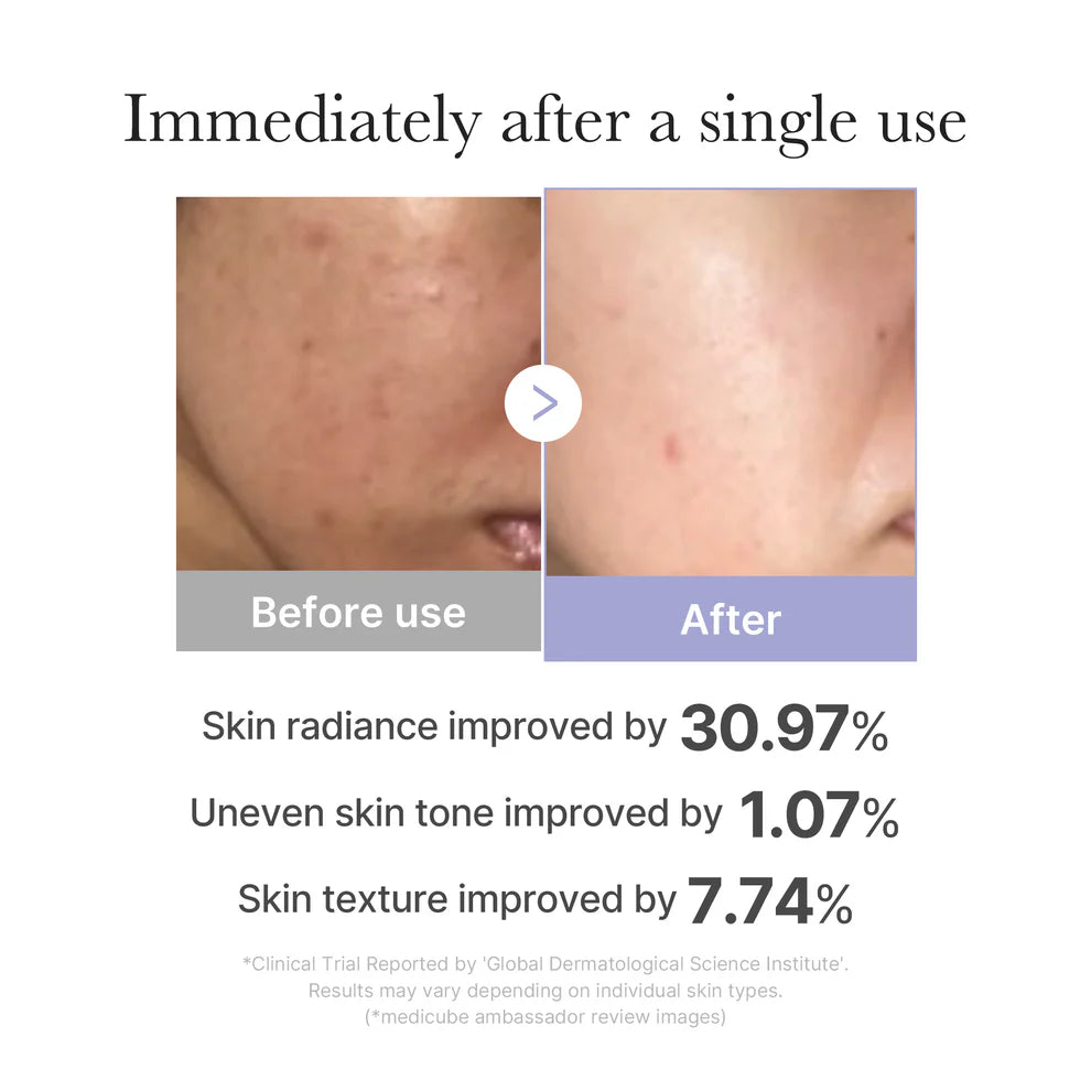 https://cdn.shopify.com/s/files/1/0681/2296/8306/files/MEDICUBE-AGE-RBoosterProMiniBeautyTool6.png?v=1762791950
