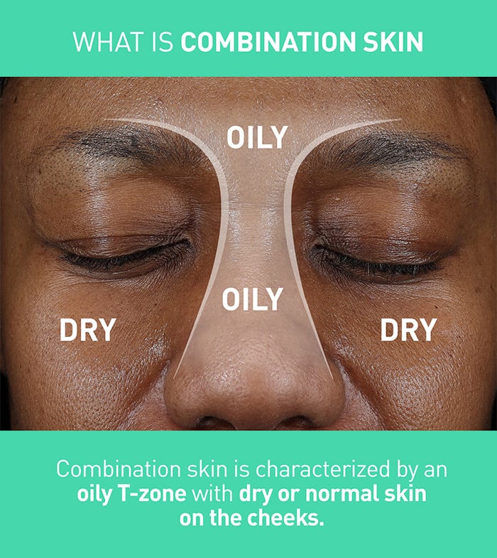 https://www.cerave.com/-/media/project/loreal/brand-sites/cerave/americas/us/skincare/cleansers/air-foam-foaming-facial-cleanser/700x785/air-foam-pdp-images-700x785-05-v1.jpg?rev=56c867e6ec2a4cdf868bdcef4ded314d